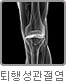 퇴행성 관절염